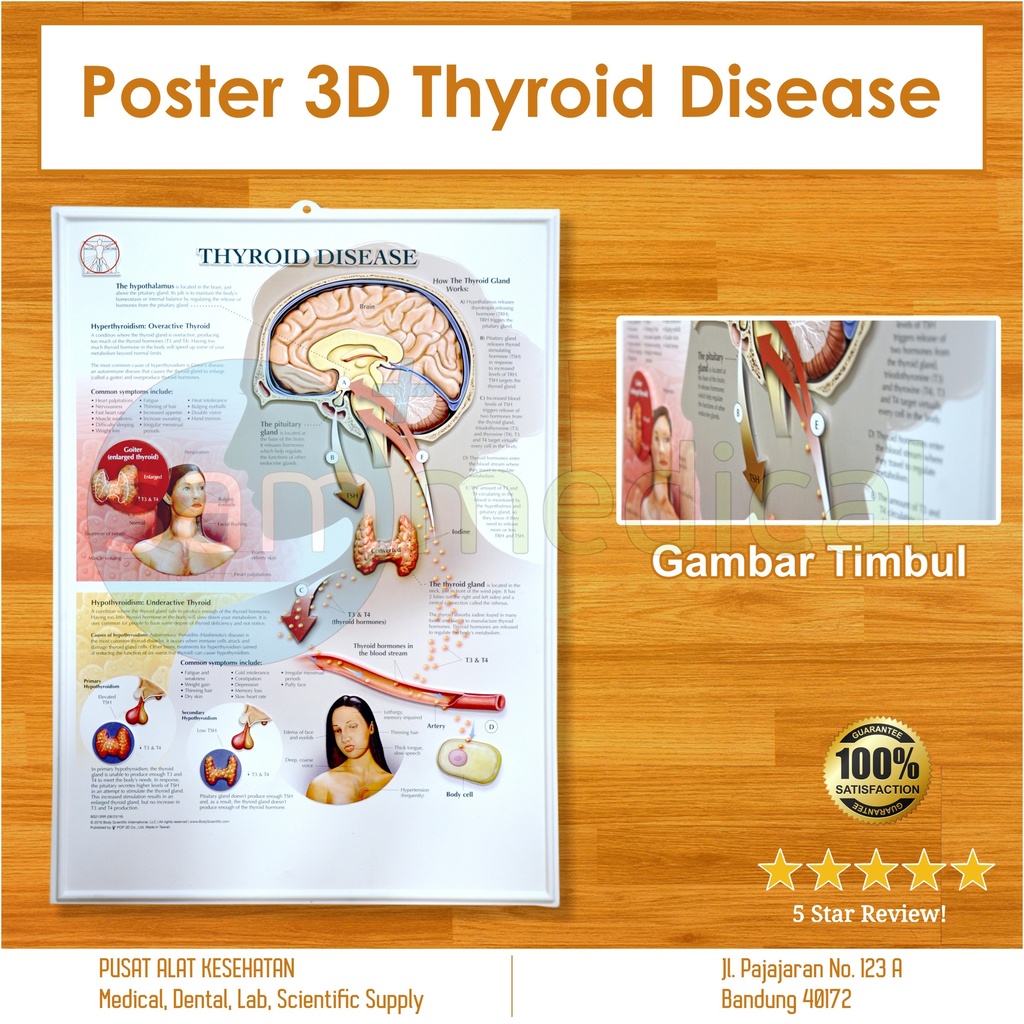 Poster 3D Thyroid Desease BS 213 RR | sam medical